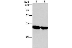 Western Blot analysis of Human fetal liver and liver cancer tissue using AADAC Polyclonal Antibody at dilution of 1:600 (AADAC 抗体)