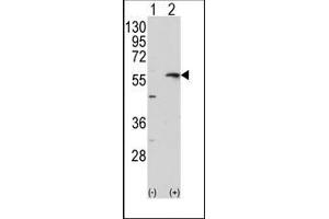 Image no. 1 for anti-Matrix Metallopeptidase 13 (Collagenase 3) (MMP13) (C-Term) antibody (ABIN358686)