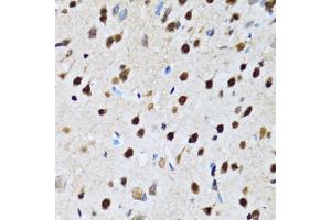 Immunohistochemistry of paraffin-embedded rat brain using CCAR2 antibody (ABIN5974285) at dilution of 1/100 (40x lens). (CCAR2 抗体)