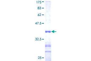 USP11 Protein (AA 201-300) (GST tag)