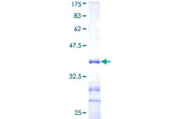 USP11 Protein (AA 201-300) (GST tag)