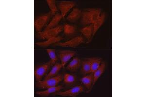 Immunofluorescence analysis of U2OS cells using PPP1R12A Rabbit pAb (ABIN6128260, ABIN6146059, ABIN6146061 and ABIN6213896) at dilution of 1:100 (40x lens). (PPP1R12A 抗体  (AA 1-200))