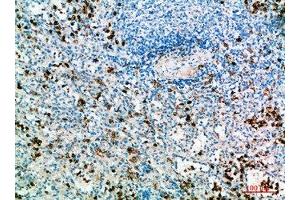 Immunohistochemistry (IHC) image for anti-Interleukin 31 (IL31) (AA 21-70) antibody (ABIN7189464)