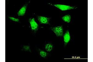 Immunofluorescence of monoclonal antibody to UCKL1 on NIH/3T3 cell. (UCKL1 抗体  (AA 301-400))