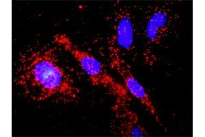 Proximity Ligation Analysis of protein-protein interactions between PTK2 and APC. (FAK 抗体  (AA 1-680))