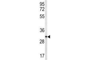 Western blot analysis of TRAP antibody and NCI-H460 lysate