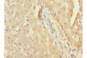 Immunohistochemistry of paraffin-embedded human liver tissue using ABIN7166660 at dilution of 1:100 (DHX3 (AA 694-1000) 抗体)