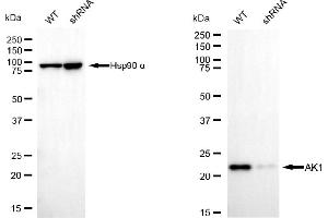 anti-Adenylate Kinase 1 (AK1) antibody