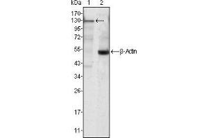 Western blot analysis using JAK3 mouse mAb against Jurkat cell lysate (1). (JAK3 抗体)