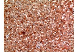 Immunohistochemistry (IHC) analysis of paraffin-embedded Human Liver, antibody was diluted at 1:100. (alpha 2 Macroglobulin 抗体  (Internal Region))