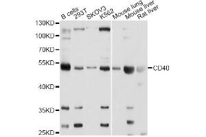 Western blot analysis of extracts of various cell lines, using CD40 Antibody. (CD40 抗体)