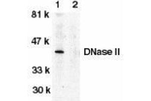Western Blotting (WB) image for anti-Deoxyribonuclease II, Lysosomal (DNASE2) (C-Term) antibody (ABIN2473351)