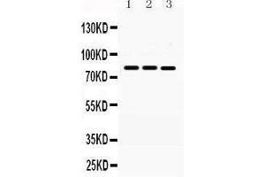 Western Blotting (WB) image for anti-Menage A Trois Homolog 1, Cyclin H Assembly Factor (Xenopus Laevis) (MNAT1) (AA 92-278) antibody (ABIN3043583)