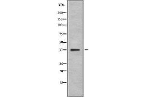 NEUROD4 Antikörper  (N-Term)