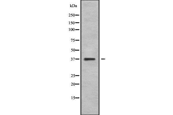 NEUROD4 Antikörper  (N-Term)