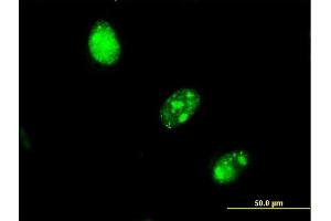 Immunofluorescence of monoclonal antibody to RBAF600 on HeLa cell.