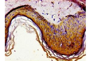 Immunohistochemistry (IHC) image for anti-Growth Arrest-Specific 1 (GAS1) (AA 248-318) antibody (ABIN7154478)