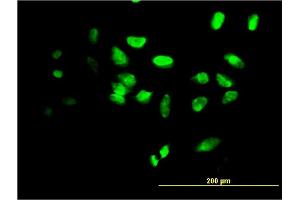 Immunofluorescence of monoclonal antibody to FOXF2 on HeLa cell. (FOXF2 抗体  (AA 346-443))