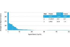 Analysis of Protein Array containing more than 19,000 full-length human proteins using Cytokeratin 4 Mouse Monoclonal Antibody (KRT4/2804). (KRT4 抗体  (AA 181-292))