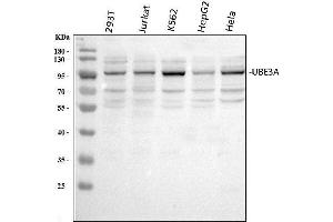 Western blot analysis of UBE3A using anti-UBE3A antibody (ABIN7599562).