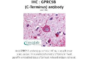 Image no. 1 for anti-G Protein-Coupled Receptor, Family C, Group 5, Member B (GPRC5B) (C-Term) antibody (ABIN1735212)