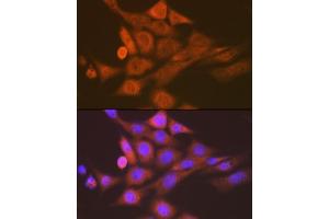 Immunofluorescence analysis of NIH-3T3 cells using SKP1 Rabbit mAb (ABIN7270120) at dilution of 1:100 (40x lens). (SKP1 抗体)