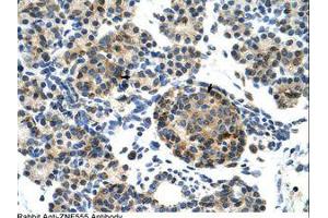 Image no. 1 for anti-Zinc Finger Protein 555 (ZNF555) (AA 128-177) antibody (ABIN6736215) (ZNF555 抗体  (AA 128-177))
