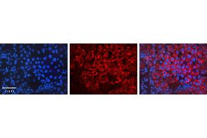 Immunohistochemistry (IHC) image for anti-Heat Shock 70kDa Protein 1A (HSPA1A) (Middle Region) antibody (ABIN2777745)