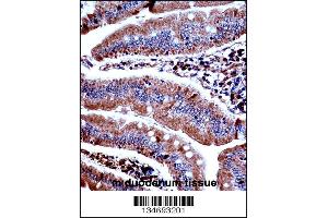 Mouse Prkd3 Antibody immunohistochemistry analysis in formalin fixed and paraffin embedded mouse duodenum tissue followed by peroxidase conjugation of the secondary antibody and DAB staining.
