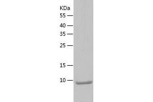 Trefoil Factor 2 Protein (TFF2) (AA 23-129) (His tag)