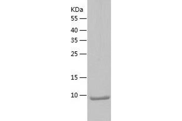 Trefoil Factor 2 Protein (TFF2) (AA 23-129) (His tag)