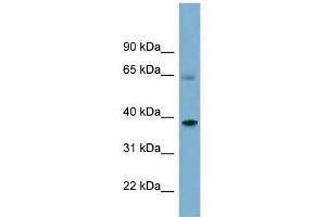 SNX7 antibody used at 1 ug/ml to detect target protein. (Sorting Nexin 7 抗体  (Middle Region))