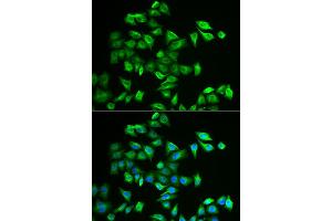 Immunofluorescence analysis of A549 cells using POMGNT2 antibody (ABIN2562968). (C3orf39 抗体)