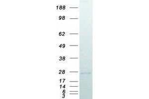 Western Blotting (WB) image for Ras-related Protein Ral-A (rala) protein (Myc-DYKDDDDK Tag) (ABIN2730430)
