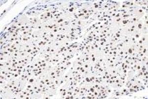 Immunohistochemistry (Paraffin-embedded Sections) (IHC (p)) image for anti-Ring Finger Protein 1 (RING1) antibody (ABIN7075467)
