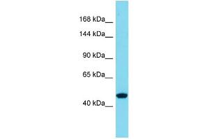 Host:  Rabbit  Target Name:  SLC39A10  Sample Type:  Thyroid Tumor lysates  Antibody Dilution:  1.