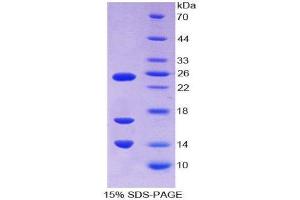 SDS-PAGE (SDS) image for Cathelicidin Antimicrobial Peptide (CAMP) (AA 31-170) protein (His tag) (ABIN2123814) (Cathelicidin Protein (AA 31-170) (His tag))