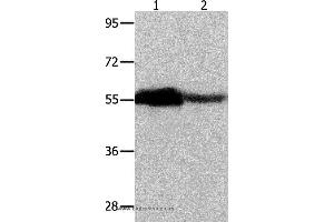 Western blot analysis of Human ovarian cancer and mouse heart tissue, using CBX2 Polyclonal Antibody at dilution of 1:350 (CBX2 抗体)