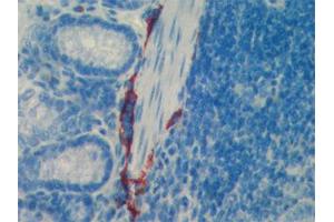 Immunohistochemistry detection of endogenous LYVE-1 in paraffin-embedded sections of mouse intestine using anti-LYVE-1 (mouse), pAb  (red staining of lymphatic endothelial intestine cells). (LYVE1 抗体  (AA 24-228))