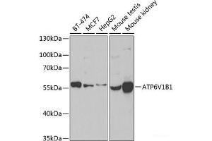 Western blot analysis of extracts of various cell lines using ATP6V1B1 Polyclonal Antibody at dilution of 1:1000. (ATP6V1B1 抗体)