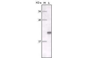 Western Blot showing MER antibody used against full-length MER recombinant protein. (MERTK 抗体)