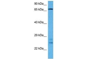 Western Blotting (WB) image for anti-delta-Like 1 (DLL1) (N-Term) antibody (ABIN2782684)
