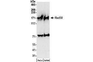 Western Blotting (WB) image for anti-RAD50 Homolog (S. Cerevisiae) (RAD50) (AA 700-750) antibody (ABIN7449388)