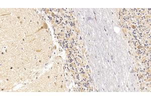 Immunohistochemistry (IHC) image for anti-Sema Domain, Seven Thrombospondin Repeats (Type 1 and Type 1-Like), Transmembrane Domain (TM) and Short Cytoplasmic Domain, (Semaphorin) 5B (SEMA5B) (AA 350-602) antibody (ABIN7426943)