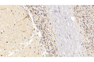 Detection of SEMA5B in Human Cerebellum Tissue using Monoclonal Antibody to Semaphorin 5B (SEMA5B) (SEMA5B 抗体  (AA 350-602))