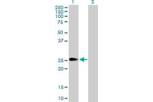 Western Blot analysis of PIP5K1C expression in transfected 293T cell line by PIP5K1C MaxPab polyclonal antibody. (PIP5K1C 抗体  (AA 1-206))