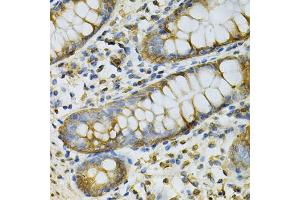 Immunohistochemistry of paraffin-embedded human colon using GSTM2 Antibody. (GSTM2 抗体)