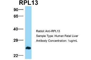Host:  Rabbit  Target Name:  RPL13  Sample Type:  Human Fetal Liver  Antibody Dilution:  1. (RPL13 抗体  (C-Term))