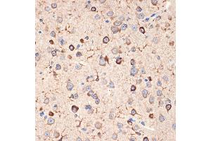 Immunohistochemistry of paraffin-embedded mouse brain using Musashi-2 (Musashi-2 (MSI2)) Rabbit mAb (ABIN7268701) at dilution of 1:100 (40x lens). (MSI2 抗体)