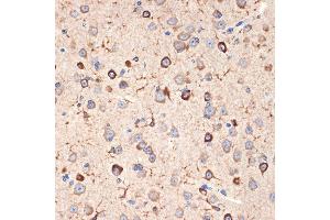 Immunohistochemistry of paraffin-embedded mouse brain using Musashi-2 (Musashi-2 (MSI2)) Rabbit mAb (ABIN7268701) at dilution of 1:100 (40x lens).